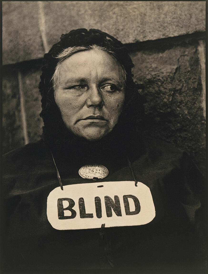 Photograph of woman wearing a sign around her neck that reads "BLIND." Photograph of woman wearing a sign around her neck that reads "BLIND."