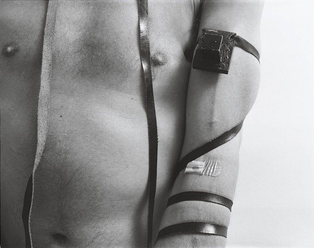 Photograph showing torso and arm, with bandage and tefillin attached.